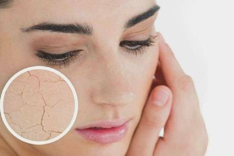 Sausa āda un tās kopšana